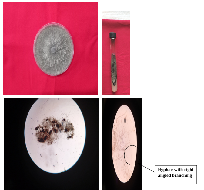 Figure 2: Morphological identification of M. phaseolina.