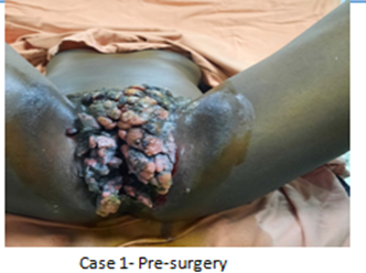 Figure 1: Case 1 pre-surgery.