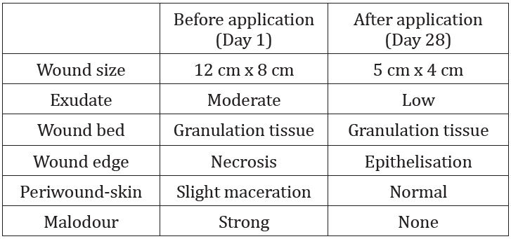 Table 1: Case report 1: Wound status of the patient before
and after treatment with curea P1 DUO active.