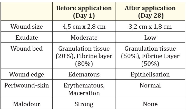 Table 2: Case report 2: Wound status of the patient before and after treatment with curea P2 active.