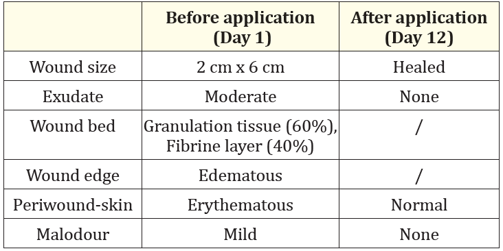 Table 3: Case report 3: Wound status of the patient before and after treatment with curea P2 active.