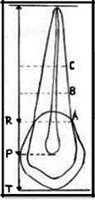 Figure 1: Diagram of premolar showing measurement sites: pulp root length (R), pulp-tooth length (P), tooth-root length (T), pulp root width at cemento-enamel junction (A), pulp-root width at midroot level (C) and pulp-root width at midpoint between level C and A (B) [11].