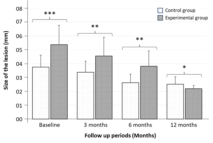 Figure 1: A comparative analysis of lesion size (mm) between Control group and Experimental group after 3-, 6- and 12-months observation period. Data are expressed as Mean ± SD (n = 32) and significance was set at 5% level: P < 0.05 (*), 1% level: P < 0.01 (**), and 0.1% level: P < 0.001 (***) compared to control.