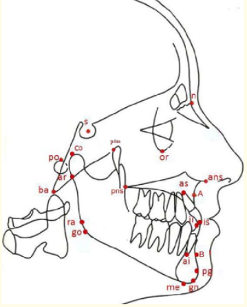 Figure 1: Cephalometric landmarks.
