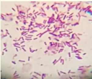 Figure 1: Gram negative rods.