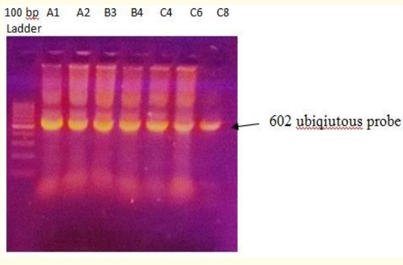 Figure 2: Gel electrophoresis of PCR amplification of
anaerobic bacteria using ubiquitous primer (602 bp).