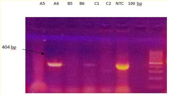 Figure 3: Gel electrophoresis of PCR amplicon (404 bp) for the
detection of Porphyromonas gingivalis using PCR specific primers.
Lanes (2, 4, and 6). Lane 7 as a negative control.