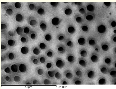 Figure 10: A SEM photomicrograph for the middle third of an
irradiated ‘5.25% NaOCl + MTAD’ irrigated root canal surface
“Group II, subgroup C” showing a clean, debris free surface with
visible dentinal tubules openings (X 2000).