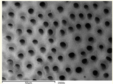 Figure 12: A SEM photomicrograph for the apical third of an irradiated ‘5.25% NaOCl + MTAD’ irrigated root canal surface “Group
II, subgroup C” showing a clean, debris free surface with visible
dentinal tubules openings (X 2000).