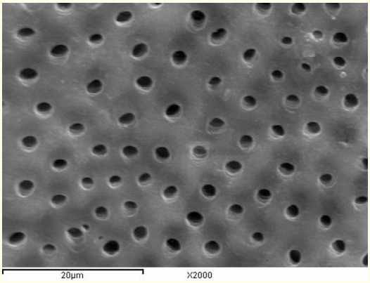 Figure 3: A SEM photomicrograph for the middle third of a
non-irradiated ‘5.25% NaOCl + EDTA’ irrigated root canal surface
“Group I, subgroup B” showing a clean, debris free surface with
visible dentinal tubules openings and areas of erosion  (X 2000).