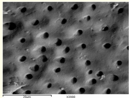 Figure 5: A SEM photomicrograph for the apical third of a non-irradiated ‘5.25% NaOCl + EDTA’ irrigated root canal surface “Group
I, subgroup B” showing an almost clean surface, with
visible dentinal tubules openings (X 2000).