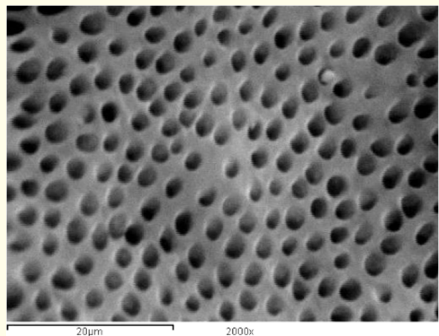 Figure 7: A SEM photomicrograph for the coronal third of a
non-irradiated ‘5.25% NaOCl + MTAD’ irrigated root canal surface
“Group I, subgroup C” showing a clean, debris free surface with
many visible dentinal tubule’s openings (X 2000).