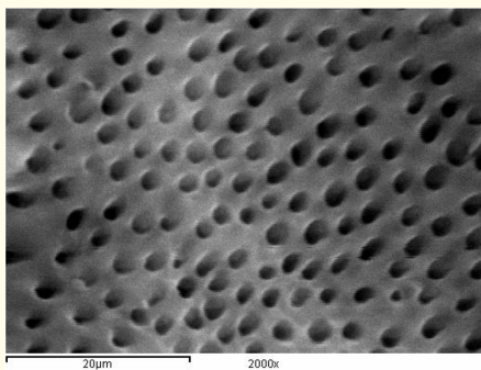 Figure 9: A SEM photomicrograph for the middle third of a
non-irradiated ‘5.25% NaOCl + MTAD’ irrigated root canal surface
“Group I, subgroup C” showing a clean, debris free surface with
visible dentinal tubules openings (X 2000).
