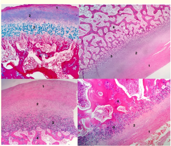 Figure 11: Fibrous articular layer (1). Proliferative layer
(2). Hyperplasic cartilage layer (3). Islands of cartilage (4).