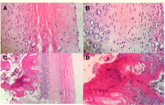 Figure 4: A) Fibrous articular layer, B) Proliferative layer,
C) Hyperplasic cartilage layer, D) Islands of cartilage. 