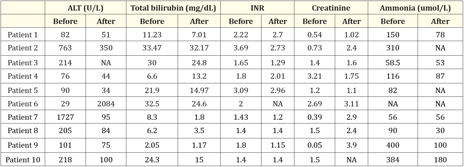 Table 2: The laboratory results between the peak values before DPMAS and after DPMAS.
Abbreviations: ALT: Alanine Aminotransferase; INR: International Normalized Ratio; NA: Not Available