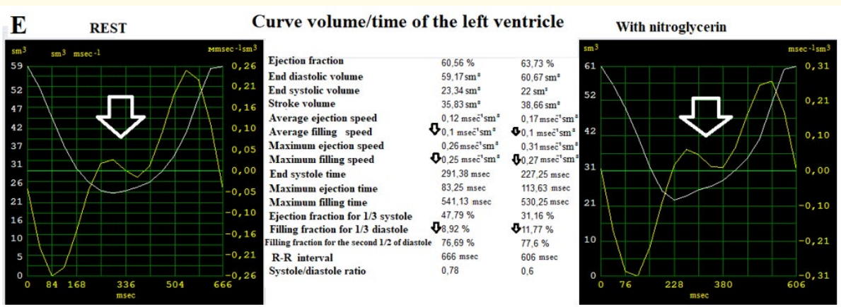 Figure D