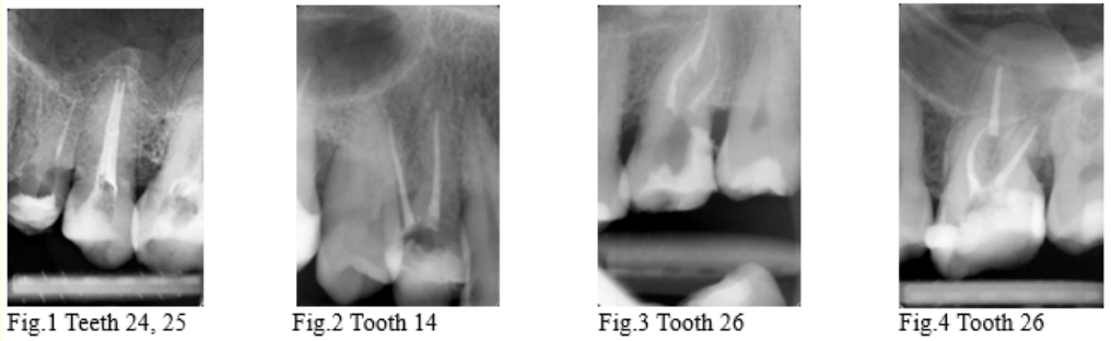 Figure 1, 2, 3, 4