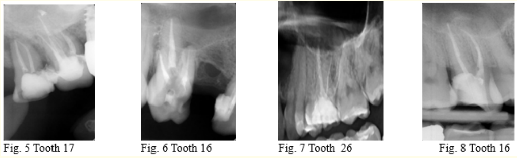 Figure 5, 6, 7, 8