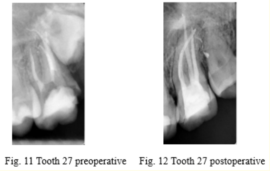 Figure 11, 12