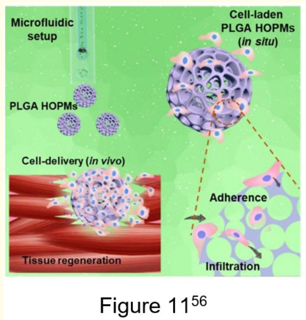 Figure 11: Schematic of the PLGA HOPMs for minimally invasive
cell delivery-based tissue regeneration [56]. <br>
This image displays Kankala., et al. fabricated PLGA-based
porous microspheres to deliver skeletal myoblasts.