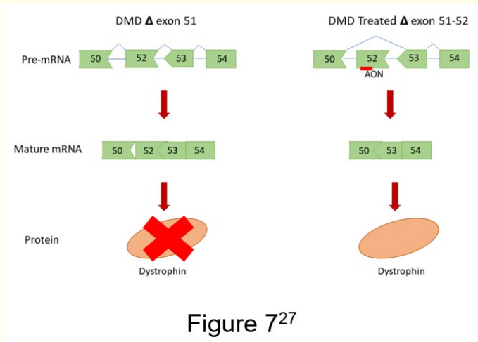 Figure 7: Illustration of the mechanism of exon skipping
therapy by skipping of exon 52 [27]. <br>
The image shows the mechanism of exon skipping therapy of
skipping exon 52. Exon skipping restores the dystrophin protein
by antisense oligonucleotides (AONs) binding to specific exons
and inducing splicing in pre-mRNA.