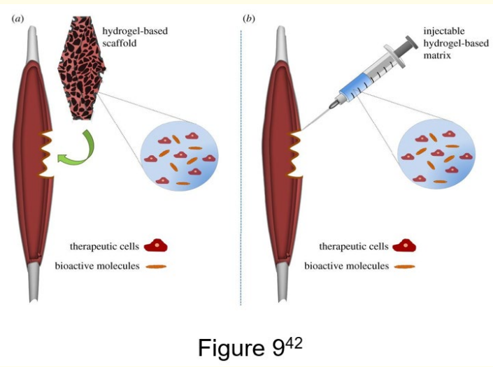 Figure 9: Typical administration of hydrogel-based delivery
systems for therapeutic cells and/or bioactive molecules in
treatment of DMD [42]. <br>
(a) Implantation of a pre-formed hydrogel-based scaffold. (b)
Injectable approach hydrogel-based matrix, which is a liquid
precursor of the matrix that is injected and then formed in situ,
or pre-formed hydrogel particles.