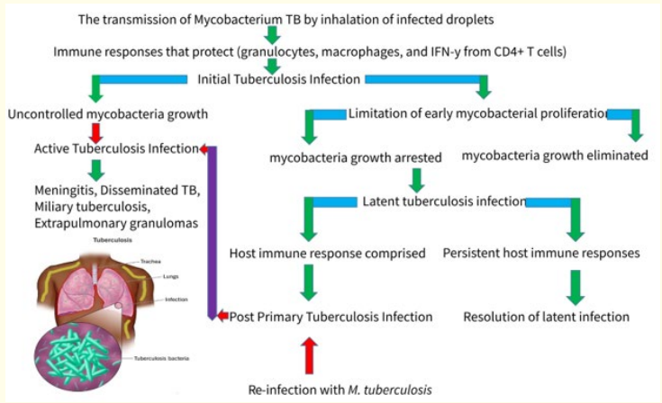 Flowchart 1: A comprehensive examination of the etiology of
human TB, as well as the course of infection and subsequent
illness consequences in individuals with a fully functioning
immune system after being exposed to infectious droplet nuclei
carrying MTBC.