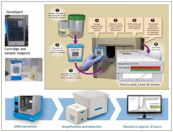 Figure 2: The flow chart shows the GeneXpert MTB/RIF ULTRA test procedure.