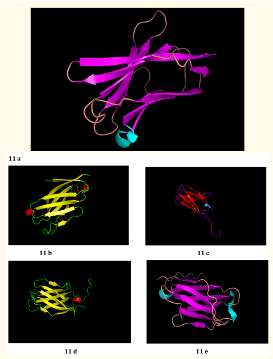 Figure 11: (a - e): Top Model (Model 1), 2, 3, 4 and 5 of R47H - TREM2 3D structure prediction by I-TASSER.