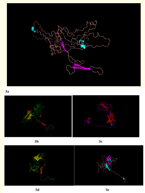 Figure 3: (a - e): Top Model (Model 1), 2, 3, 4 and 5 of TREM2 3D structure prediction by I-TASSER.