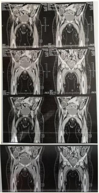 Figure 1: CAT examination of patient vessels.