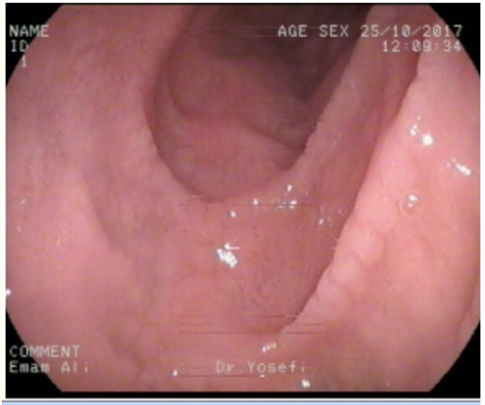 Figure 2: (duodenum). 