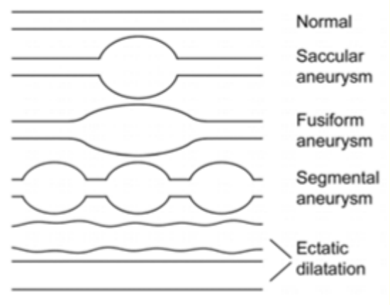 Figure 3: Coronary artery abnormalities.