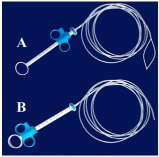 Figure 1: The Snare, [A-Loop of the Snare opened, B-Loop of 
the Snare closed] “Acusnare polypectomy snare [Cook Medical,
Wilson-cook Medical, Inc.4900 Bethania Road Winston-salem
NC27105. WWW. Cookmedical. com]. 