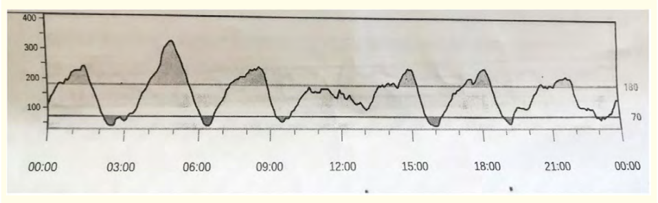 Figure 2: First day of CGM record. Feedings number: 7 (at h 3:00, 6:30, 9:00, 13:00, 16:30, 20:00, 23:30) Glicemic values expressed in mg/dL on the vertical axis. Time in hours on the Horizontal axis.