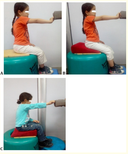 Figure 1: Rt Hemiplegic cerebral palsy child in sitting position
during reaching on horizontal surface [A], forward inclined surface [B] backward inclined surface [C].