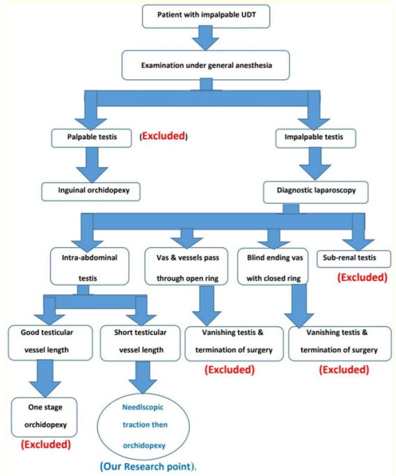 Figure 4: Figure showing our surgical flowchart of
 impalpable UDT.